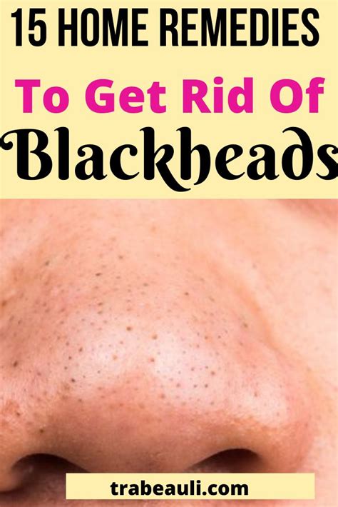 This video is about how to draw out blackheads at your home without ruining your skin. How To Remove Blackheads At Home Permanently | Blackheads ...