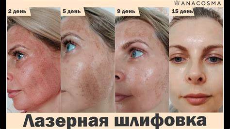 Кожа до кости диета