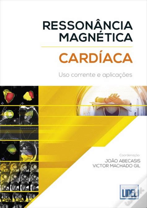 Saiba como é feito o exame de ressonância magnética. Ressonância Magnética Cardíaca - Livro - WOOK