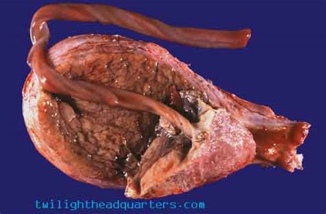 Homeopathics, like essences, are remedies that heal on a vibrational, energetic level. Placenta Recipes