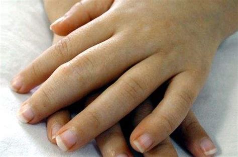 Bir inekte ise sekiz adet parmak bulunur. Parmak Enfeksiyonu - Hemen Sağlık