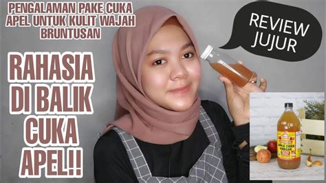 Beberapa orang mencampurkan cuka apel dengan air untuk cuci muka atau dipakai sebagai toner, dengan tujuan membunuh bakteri dan mencegah flek hitam. SKINCARE ALAMI CUKA APEL UNTUK BRUNTUSAN - RAHASIA DIBALIK ...