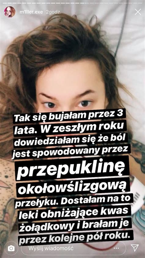 Monika ratkowska w sesji dla ckm. Monika Miller przeszła poważną operację! Pokazała zdjęcia ...