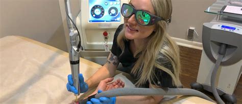 During a laser tattoo removal procedure, the practitioner guides a laser over the area of the tattoo. How Does Laser Tattoo Removal Actually Work? | Tattoo Cares