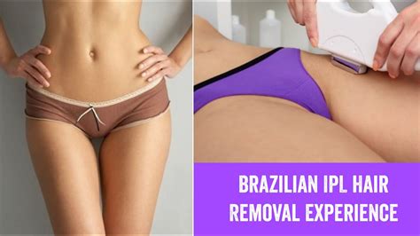 Laser hair removal procedure produces beams of light which some of the important strategies are followed when performing laser hair removal treatment. My Brazilian IPL Hair Removal Experience - YouTube