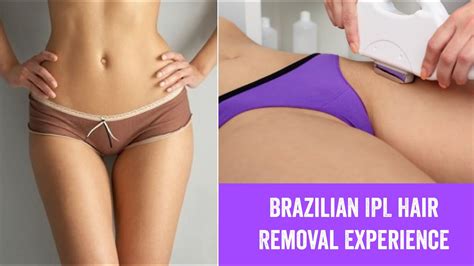 Waxing often results in ingrown hairs due to the regrowth. My Brazilian IPL Hair Removal Experience - YouTube