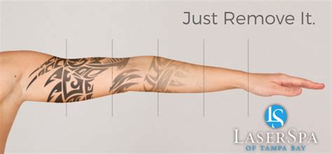 Ibrahimi says that there are many methods to minimize the pain. Laser Tattoo Removal | LaserSpa of Tampa Bay