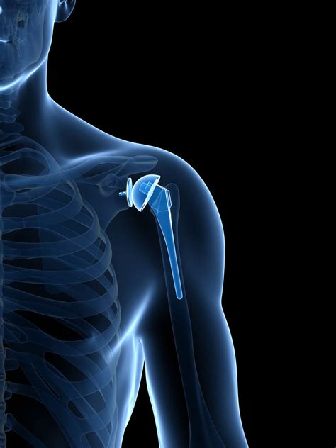 Shoulder | PINEHURST SURGICAL CLINICTruly Specialized ...