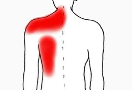 Douleur sous l'omoplate gauche derrière le dos: causes et traitement
