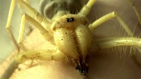 Although not poisonous, camel spider bite can be terribly painful leaving severely fierce looking wound at the bite area. Mandy the Solifugae Camel Spider - YouTube