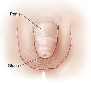 It may be a hint about a problem somewhere else in the body, such as diabetes, high blood pressure, heart disease. Balanitis (Child)