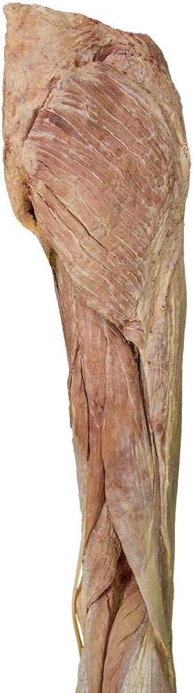 Arises from pelvis and inserts on the upper tibia. Clinical Anatomy | Atlas | Superficial Posterior Hip & Thigh