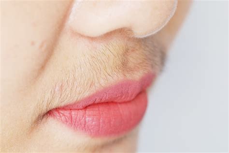 I am a woman in my 20s and i have a problem with facial hair. Hirsutism - Unwanted Hair Growth in Women | Things Health