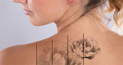 Hey there, welcome to /r/tattoos. Eyebrow & Eyelash Tinting | Laser Skin Care, Microneedling, Hair Removal, Tattoo Removal in Olds AB