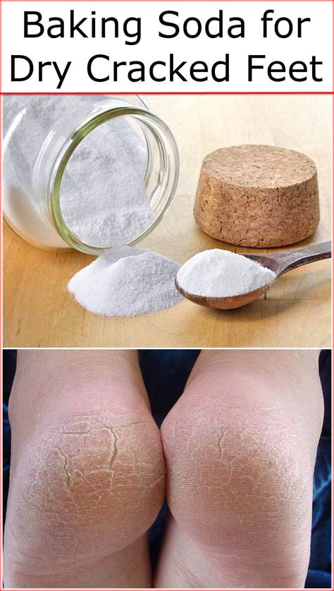 How to use baking soda as a treatment for feet calluses, foot odor, and cracked heels by the end of a working day, most people feel tired, in pains, and bad mood, just because they have been standing or walking in uncomfortable shoes and high heels. Baking Soda for Dry Cracked Feet | Baking Soda Uses and ...