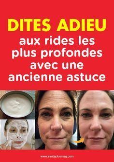 C'est pourtant de cette manière que les poux passent de tête en tête, et rampent de cheveux en cheveux. Astuce naturelle pour diminuer les rides et prévenir le ...