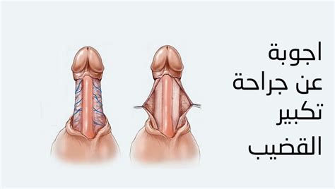 ٢ طرق تكبير حجم الذكر. كيفية تكبير العضوالذكري،هل حجم القضيب يؤثر علي العلاقه ...