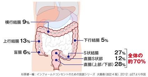 なぜ大腸内視鏡検査を受けるのか？ それは… 大腸がんを発見するためです。 胃がんリスク（abc）検査を先にお受けいただく事をお勧めしております。 ≪世田谷区の胃がん検診の目的≫. 第1回 大腸がんの基礎知識を確認! | 看護に役立つ【ナース専科 ...