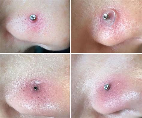 How to know if your septum piercing is infected. This are all you need to know about nose piercing and nose ...