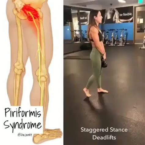 How to sleep with piriformis syndrome? Must-Do Exercise for Piriformis Syndrome📌⠀ .⠀ Thanks to ...