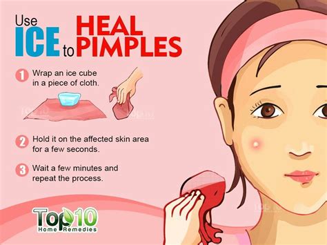 Normally, pimples that are not filled with pus take about a few days to a couple. 22 Home Remedies for Acne & Pesky Pimples | How to remove ...