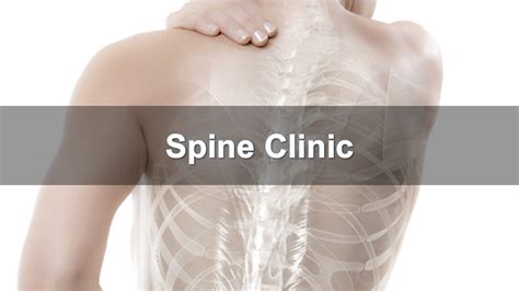 To establish continuity of care, you will see the same physiatrist during your clinical visits. Spine Clinic