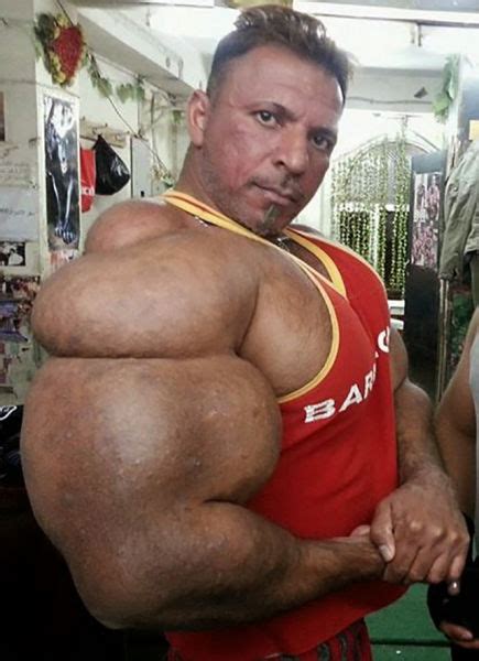 Dianabol, or in short dbol is more used for. This Guy Uses Way Too Much Synthol (20 pics)