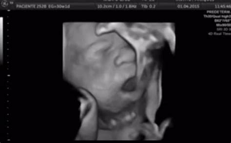 The food you eat first gets broken into many tiny elements and then it passes across the placenta to ultimately reach your baby. Fascinating video that proves babies SING in the womb | UK ...