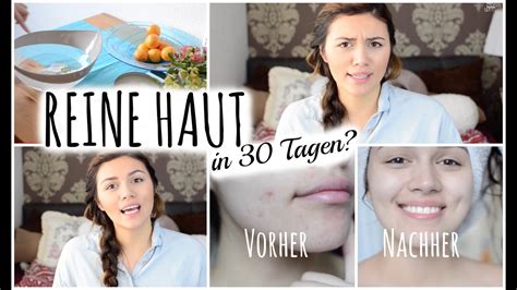 Und wie sollte rizinusöl für die haut angewendet werden? REINE HAUT in 30 Tagen? (Vorher/Nachher) # ...