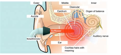 What type of hearing aid is best for tinnitus. tinnitus treatment - Neoalta Speciality Clinic