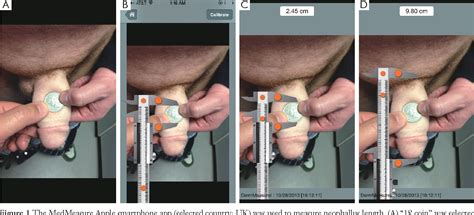 Check spelling or type a new query. How is a transgender surgery performed male to female ...