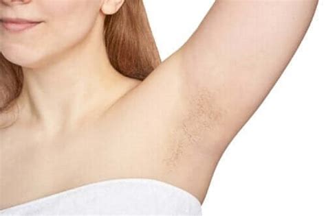After every hair cycle, some of the pigment gets lost. Why do we have armpit hair? - home remedies for life