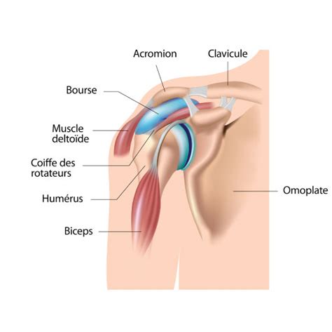 Small and shallow glenoid cavity. ChamplainMSKcare - Affections de l'épaule