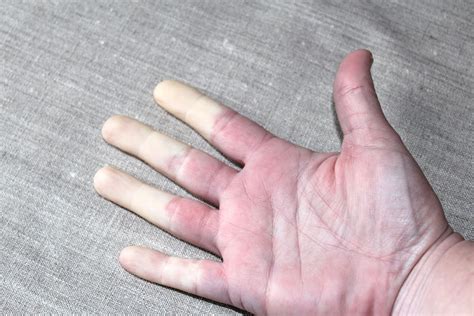 (1:15) denne gangen handler det om hjertet. Kastanjehagen: Om fingrer og sånnt...