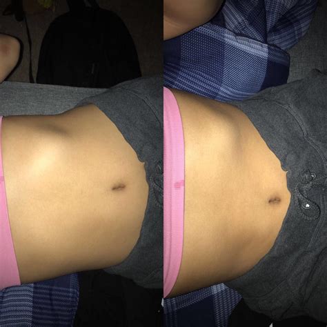 The structure in the body formed by the ribs (= bones in the chest that protect the heart, lungs…. Can anyone tell me why my left rib cage sticks out like ...
