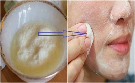 Discover how baking soda is considered a very popular natural remedy for gout sufferers and learn if it helps control uric acid levels in the blood. Mau Wajah Cantik dan Alami? INI DIA Cara Ampuh Untuk ...