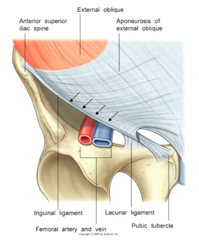 The ligament also helps to supports the iliopsoas muscles which includes the psoas major muscle that runs from your upper femur, through your pelvis, to your lower. Inguinal ligament: formed by the lower free margin of ...