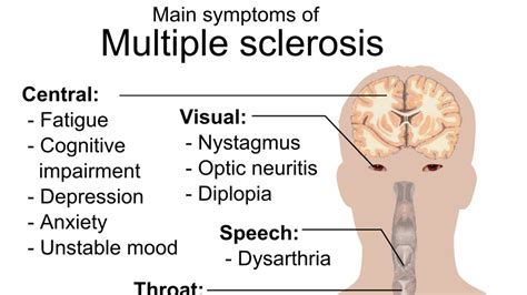 Jun 12, 2020 · multiple sclerosis signs and symptoms may differ greatly from person to person and over the course of the disease depending on the location of affected nerve fibers. CBD for MS patients: a powerhouse duo for treating ...