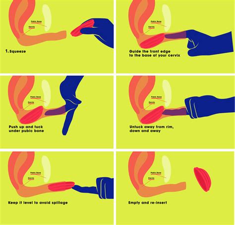 Each flex disc can only be used one time wondering how that's possible? nixit Menstrual Cup | Suction Free, One Size Menstrual ...