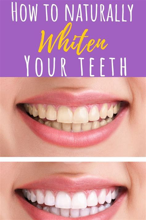 After using the strips, brush your teeth or rinse with water and make sure that the whitening gel is out of your mouth. Pin on DIY Gift Ideas