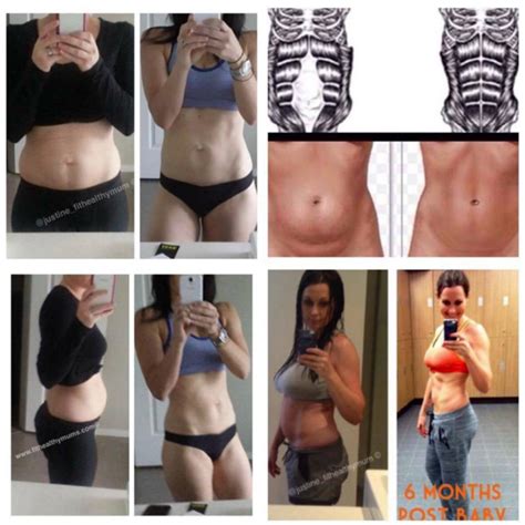 Stomach cancer is a cancer that's found anywhere in the stomach. Abdominal Separation- How to tell if you have it and what ...