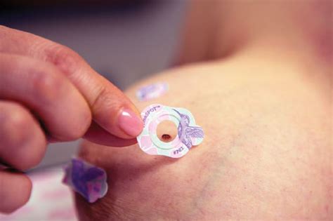 We'll show you breast cancer pictures to help you identify any physical traits of the condition. A Radiologist's Perspective:The Value of Consistent ...