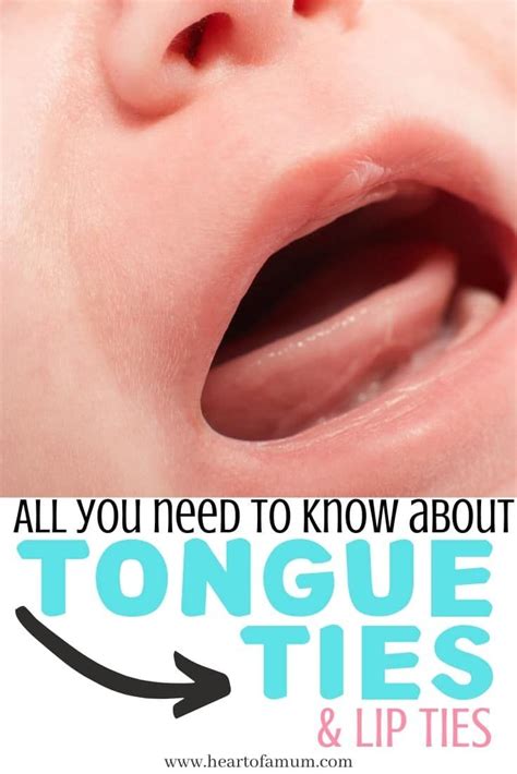 He can let them know that you just aren't ready yet to talk to them. How to tell if your baby has a tongue or lip tie | Tongue ...
