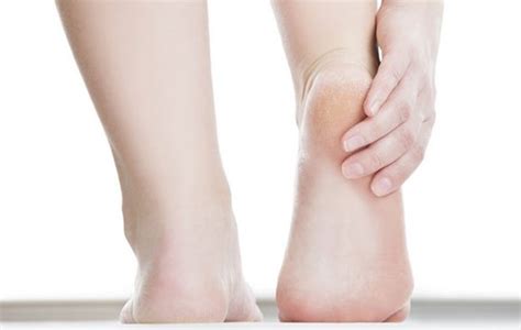 Kulit pisang dipercaya dapat digunakan. 4 Penyebab Tumit Kaki Pecah - Pecah - CantikBGT.com