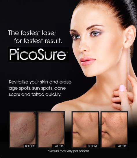 She notes that stress reduction is essential during pregnancy, but getting tattooed could actually force your body into a more severe state of pressure. Fast Dark Spot Removal with PicoSure. - Apex Profound Beauty