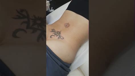 Custom tattoo studio and alternative art gallery. Laser Tattoo Removal - YouTube