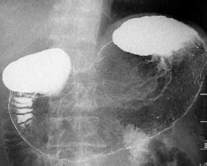 透視造影TOP 獨協医科大学埼玉医療センター 放射線部