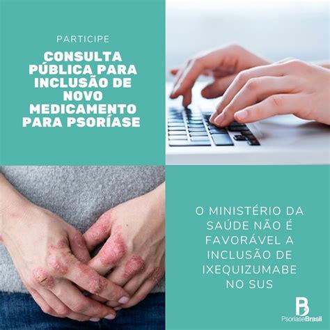 Resultados de busca psoriase sua busca por psoriase obteve 148 resultados. Psoríase | Conitec lança Consulta Pública n. 9 ...