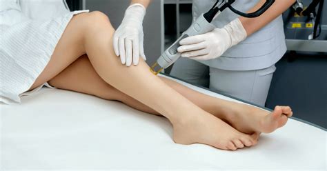 How laser hair removal works. How to Avoid a Laser Hair Removal Nightmare | Australian ...