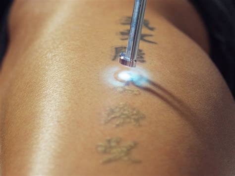 1) identify the symptoms of infection. Everything You Need to Know About Laser Tattoo Removal ...